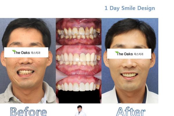 11 seoul guide medical dental patients (16)