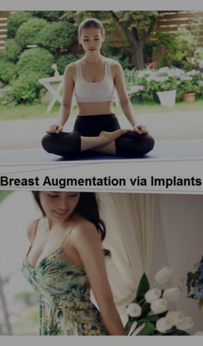 Breast Augmentation Incision Types in korea